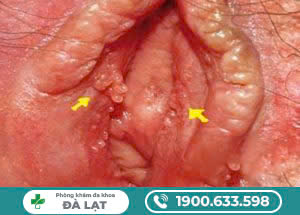 Hình ảnh minh họa